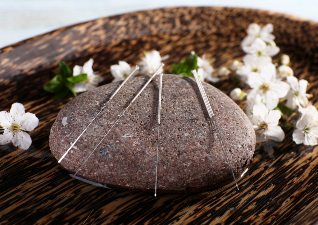 Wellness, Akupunktur, Druckbehandlung